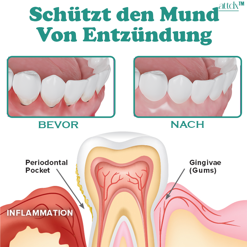 ATTDX 360° Frische Nebel Tiefenreinigendes Mundwasser