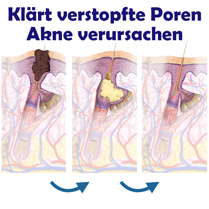 ATTDX BrustStraffende AufhellungsCreme