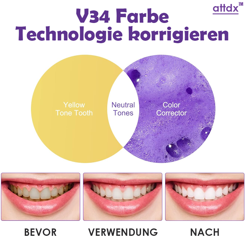 ATTDX DiamantGleiten AufhellungPRO Reinigungsmousse