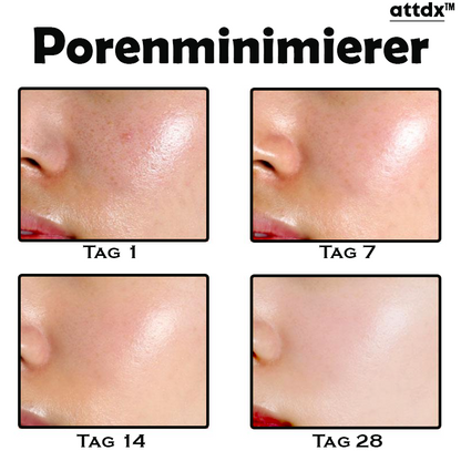 ATTDX Hautunreinheit Akne Jugend Serum