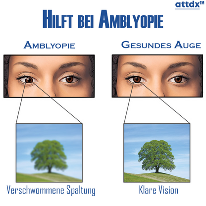 ATTDX Klare Sicht Behandlungsumkehr Augentropfen