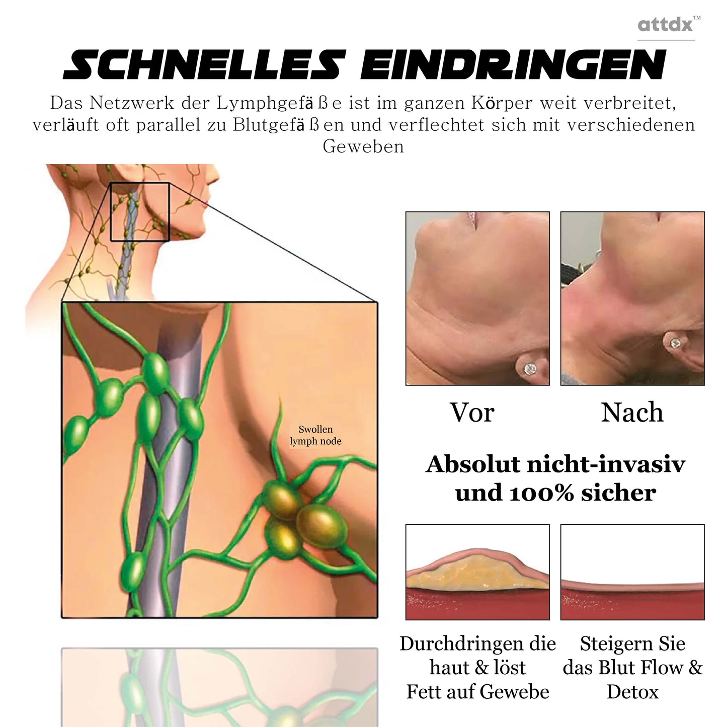 ATTDX Lymphknoten BildhauerischeEntwässerung Entgiftungscreme