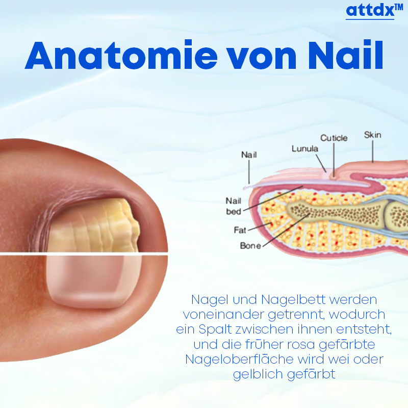 ATTDX Nagelerneuerungs Restaurierungs Serum