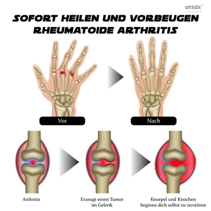 ATTDX ProRelief Kräuter Gelenkerholungscreme