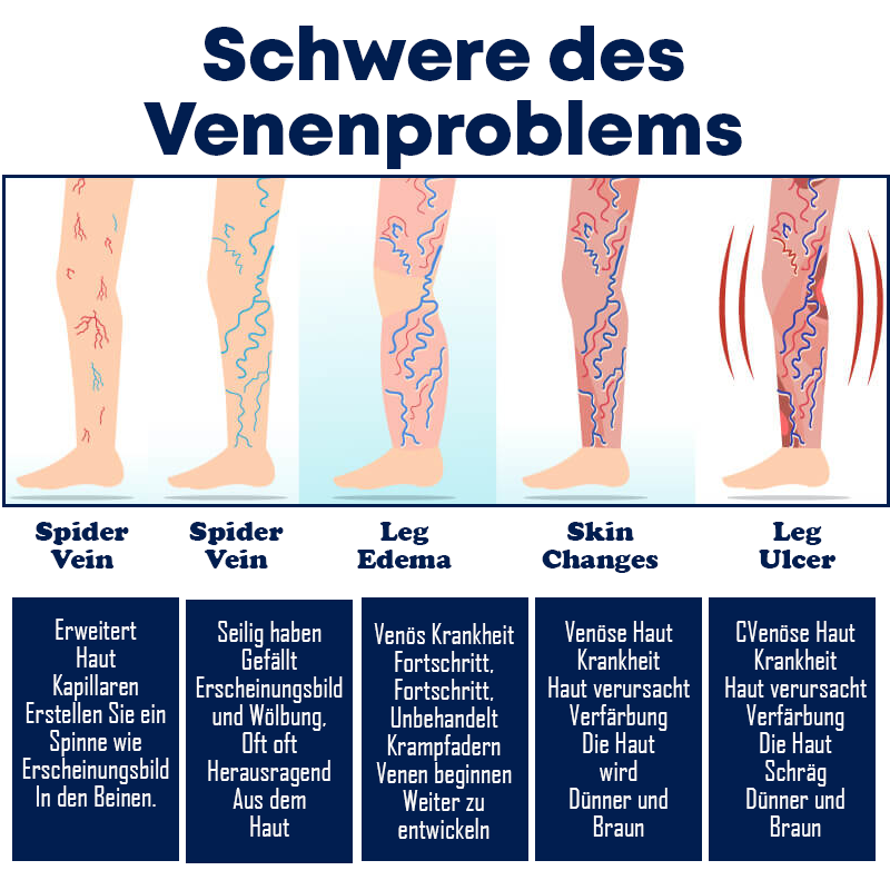 Venenpflege Beine Beruhigende Creme