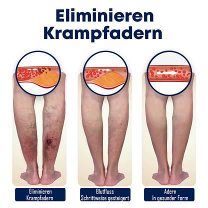 Venenpflege Beine Beruhigende Creme