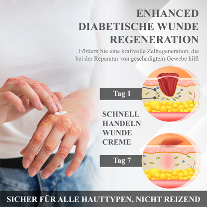 ATTDX™ Diabetische Reparatur Hautheilcreme