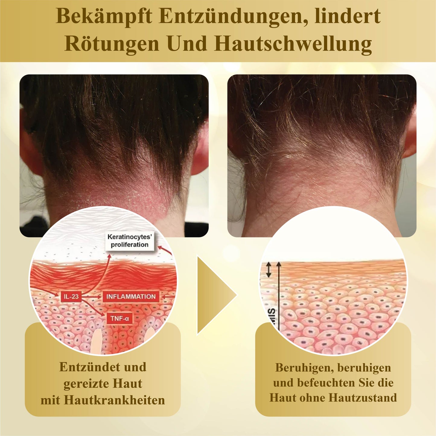 ATTDX™ Kondensierte MelliferaGift Hautreparaturcreme