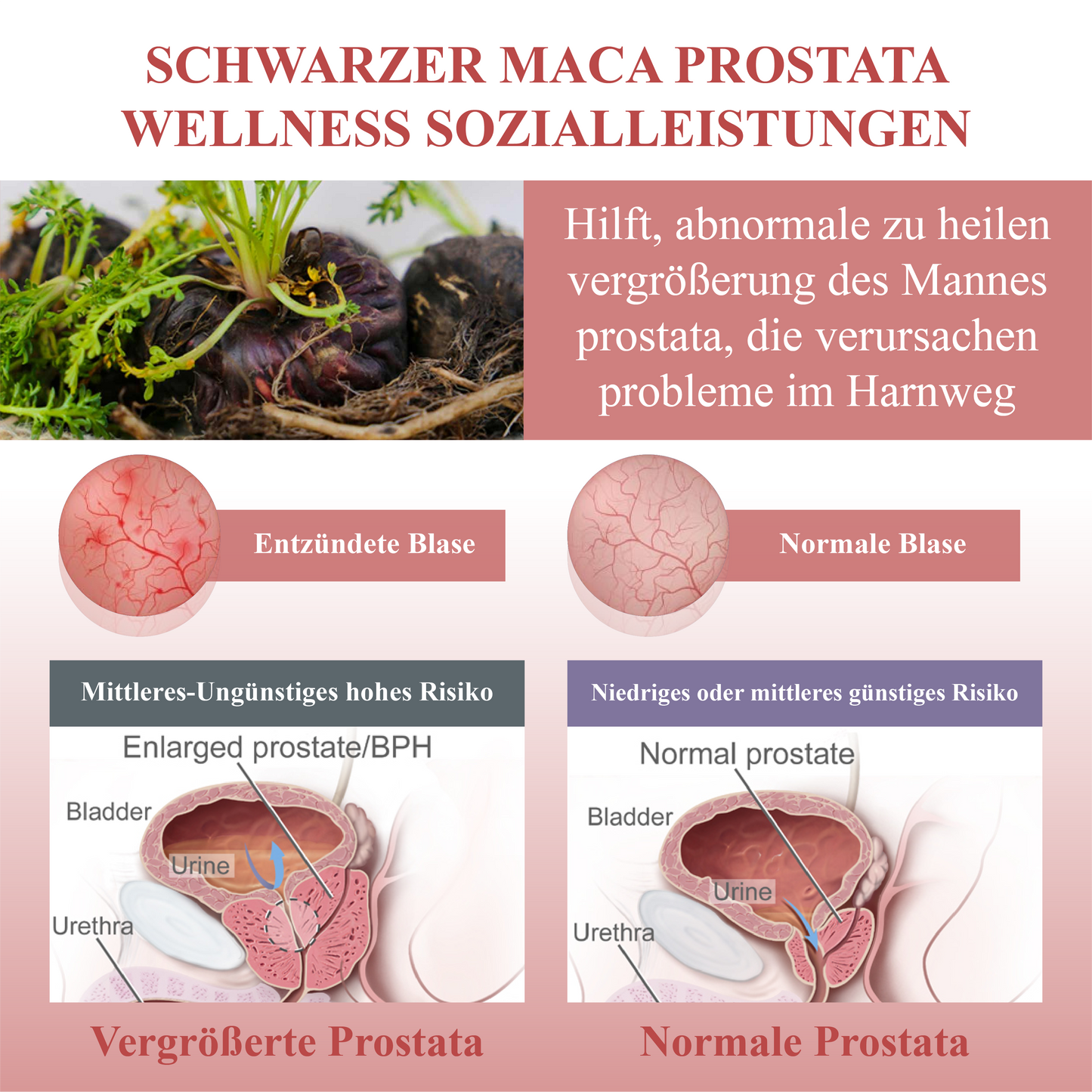 ATTDX™ Prostata Wohlbefinden Schwarze Maca Pflaste