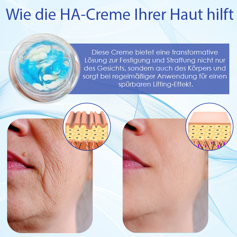 ATTDX™ Tiefenelastische Hauterneuerungs HA creme