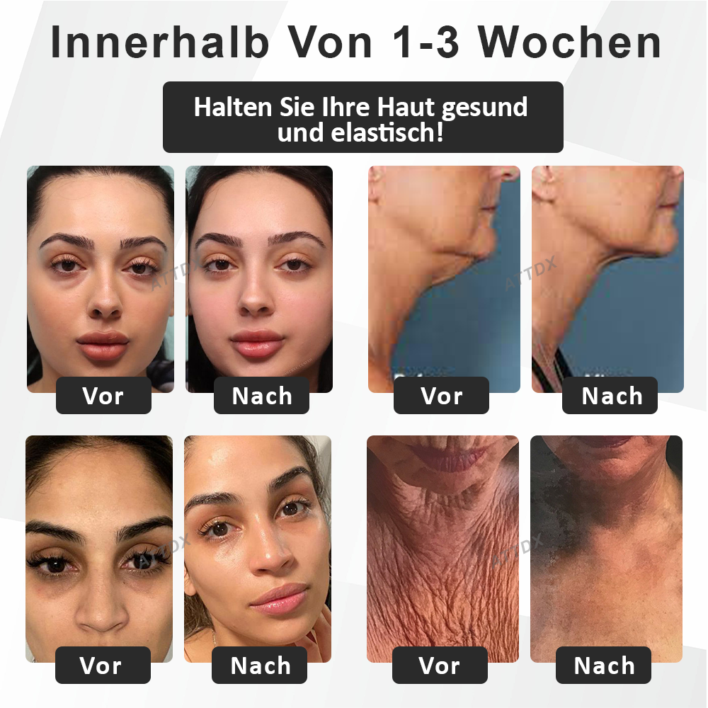 ATTDX™ Tretinoin Straffende Aufhellende Feuchtigkeitscreme