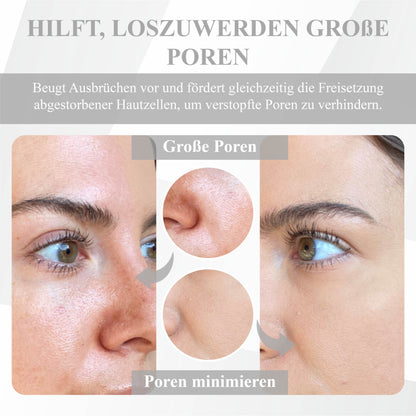 ATTDX™ Tretinoin Straffende Aufhellende Feuchtigkeitscreme