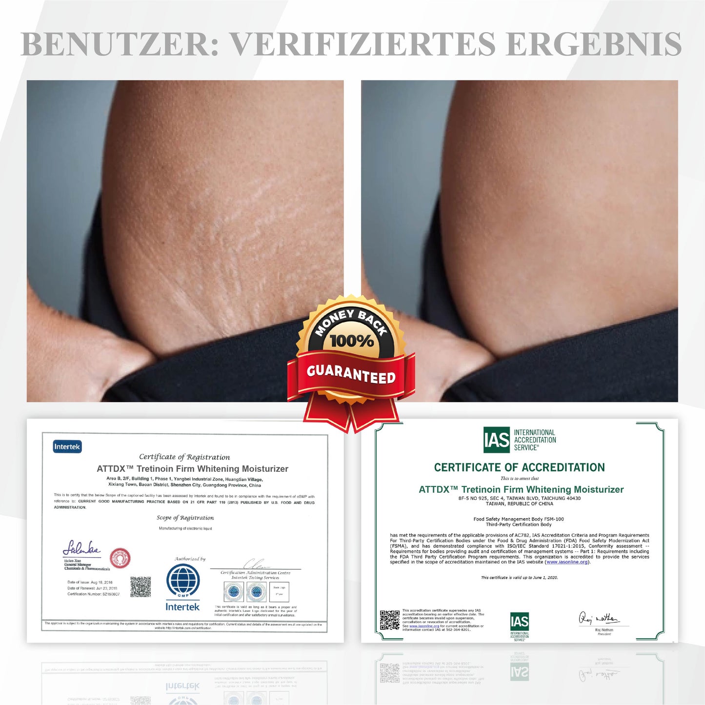 ATTDX™ Tretinoin Straffende Aufhellende Feuchtigkeitscreme