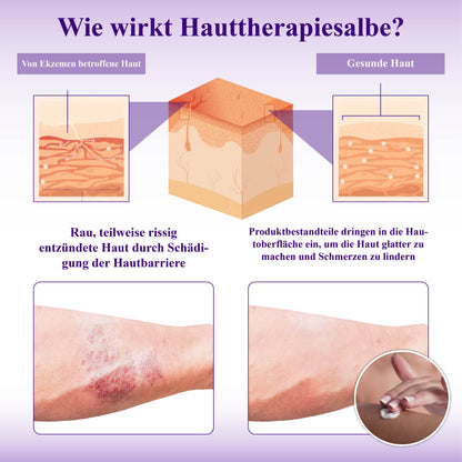 ATTDX™ Violette Beruhigende Hauttherapie Salbe