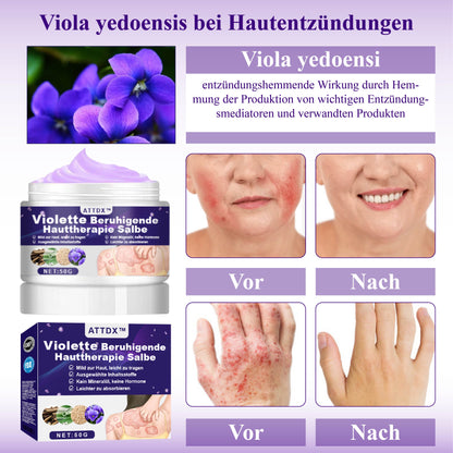 ATTDX™ Violette Beruhigende Hauttherapie Salbe