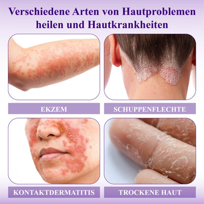 ATTDX™ Violette Beruhigende Hauttherapie Salbe