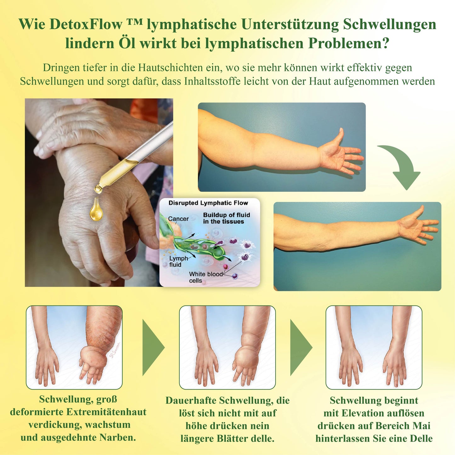 DetoxFlow™ Lymphatische Unterstützung Schwellungs