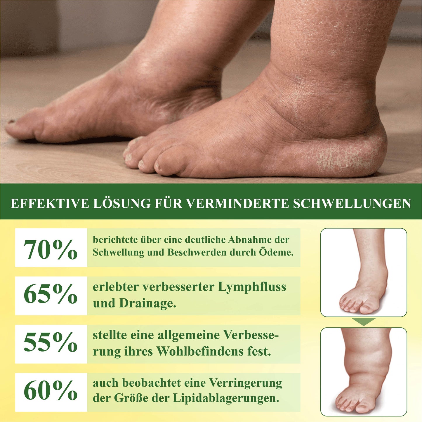 DetoxFlow™ Lymphatische Unterstützung Schwellungs