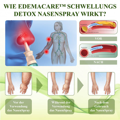 EdemaCare™ SchwellungsDetox Nasenspray