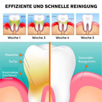 ATTDX MündlicheHeilen Zahnaufhellung Mundspülung