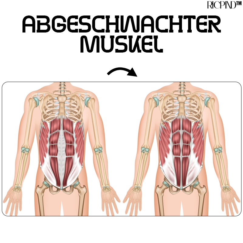 RICPIND EMS Leichtes Bauchmuskel Stimulationsgerät