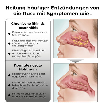 RICPIND EMS RespiRestore Nasal Therapy Gerät