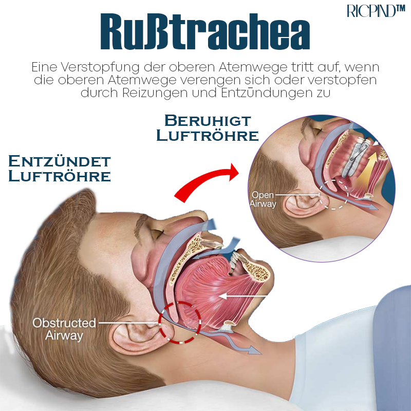 RICPIND Luftröhre Leichtigkeit SonicLight Therapie Beruhigend Instrument