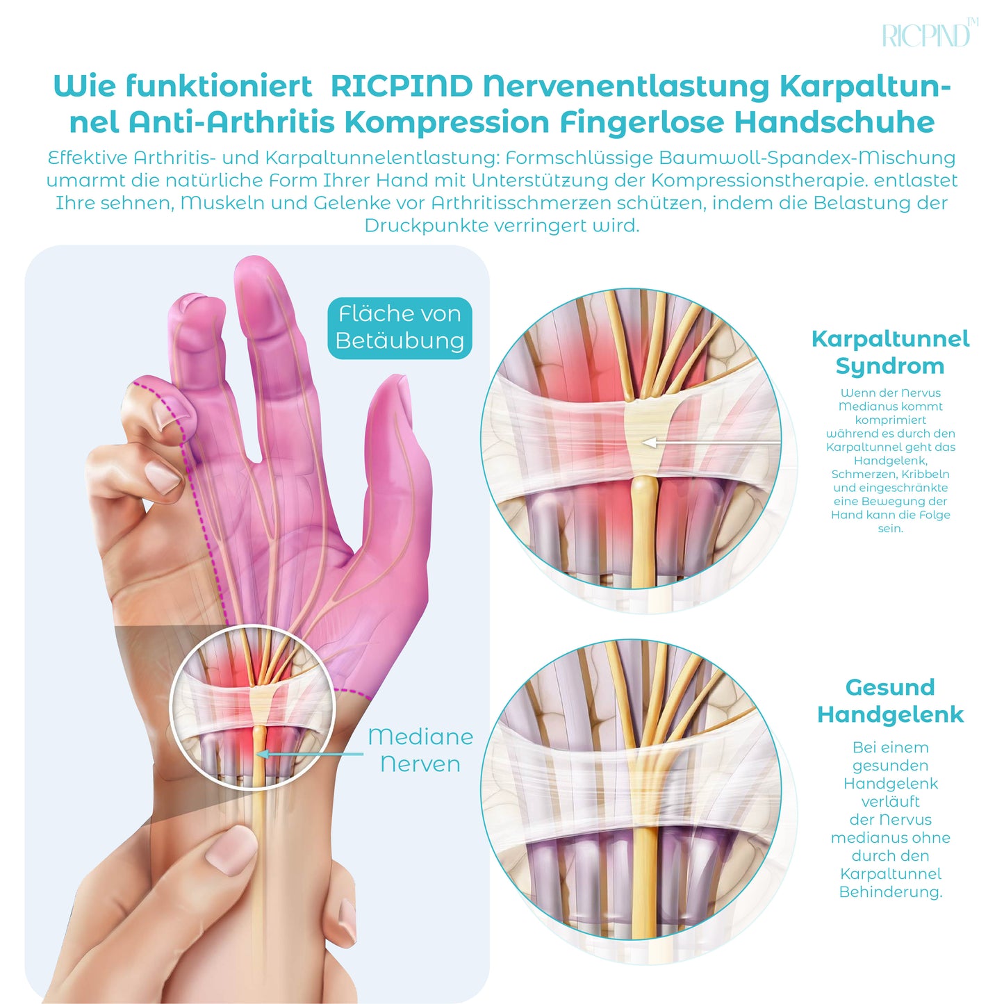 RICPIND Nervenentlastung Karpaltunnel Anti-Arthritis Kompression Fingerlose Handschuhe