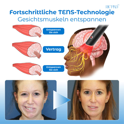 RICPIND Tinnitus Nervbehandeln InfrarotWärmestift