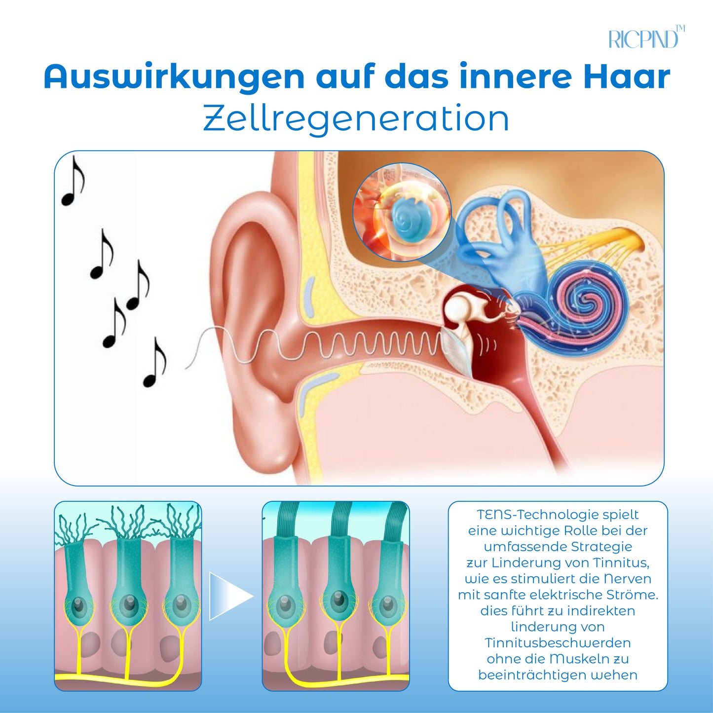 RICPIND Tinnitus Nervbehandeln InfrarotWärmestift