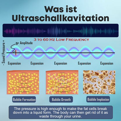 Lipidschmelze Ultraschall DetoxArmbänder