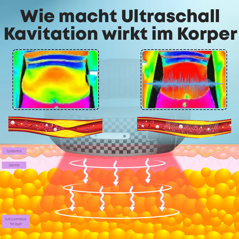 Lipidschmelze Ultraschall DetoxArmbänder