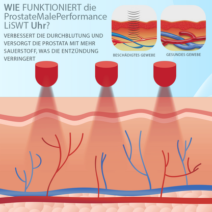 RICPIND™ ProstataMännliche Gesundheit LiSWT Uhr