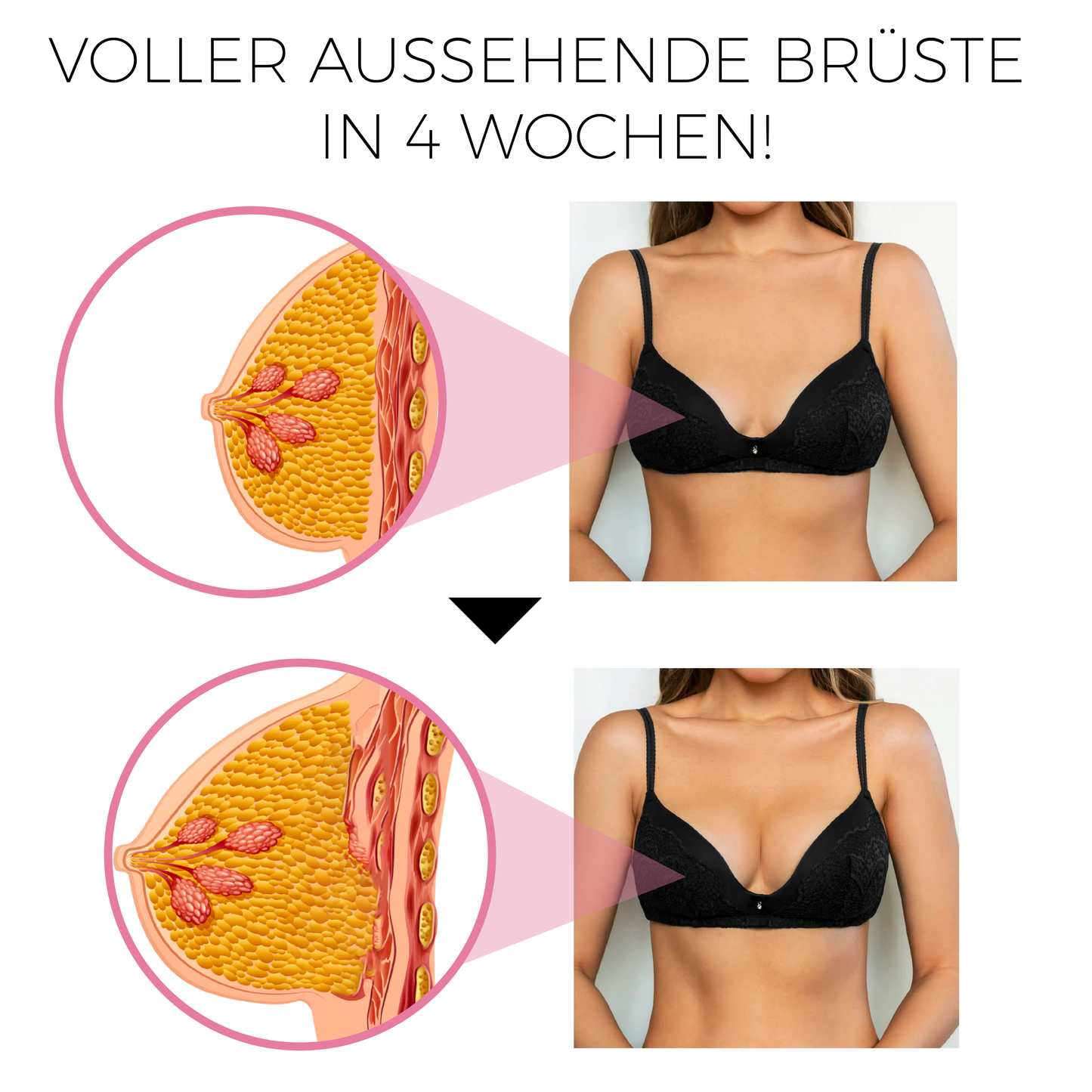 ATTDX GrößeHoch Keratopeptid Eiweiß Hebepflaster