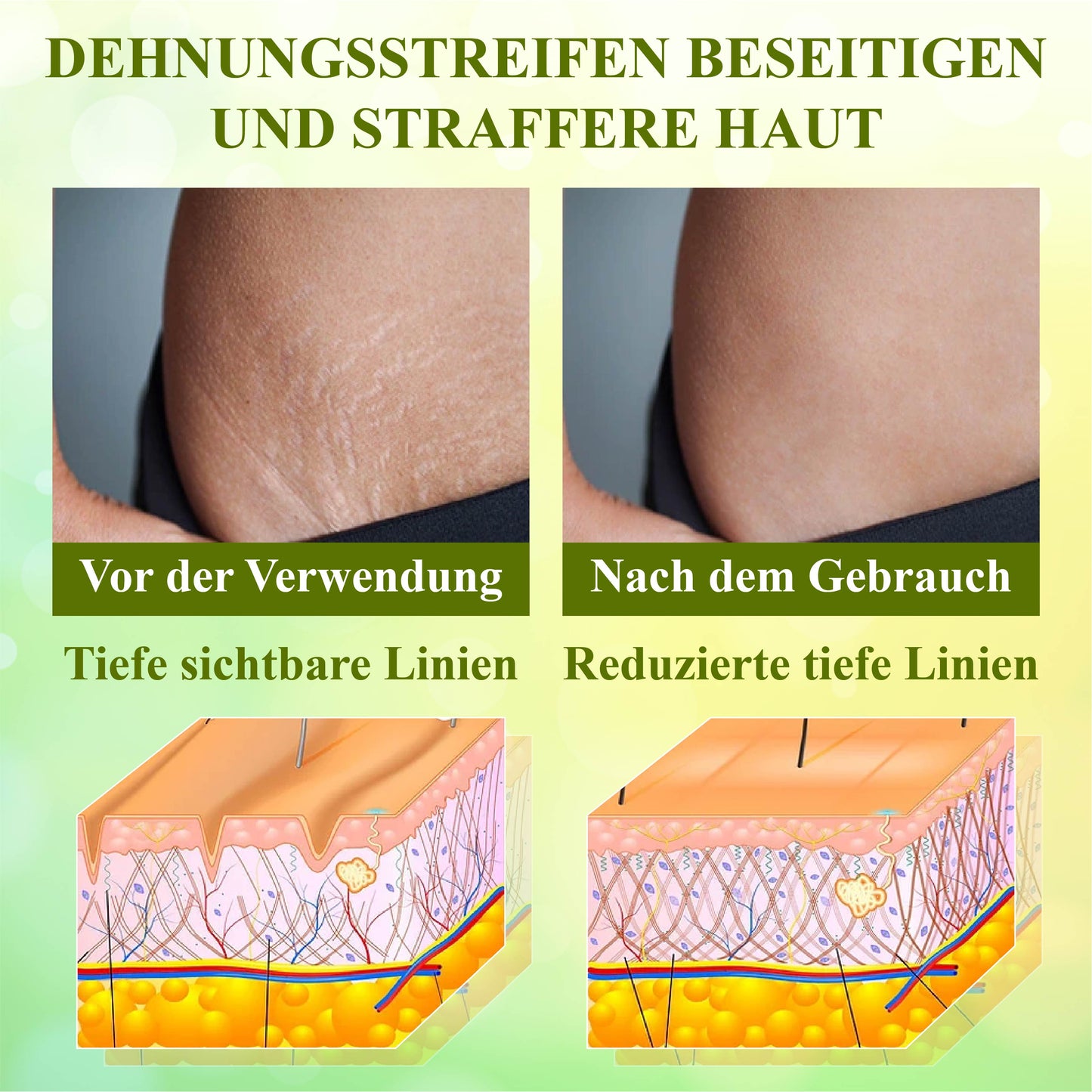 TightenLift™ Kollagen Booster Hautstraffungscreme