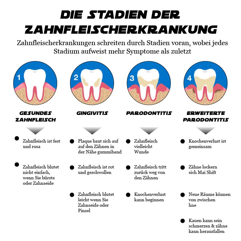 ATTDX GumErleichterung ParodontalBehandlung Gel