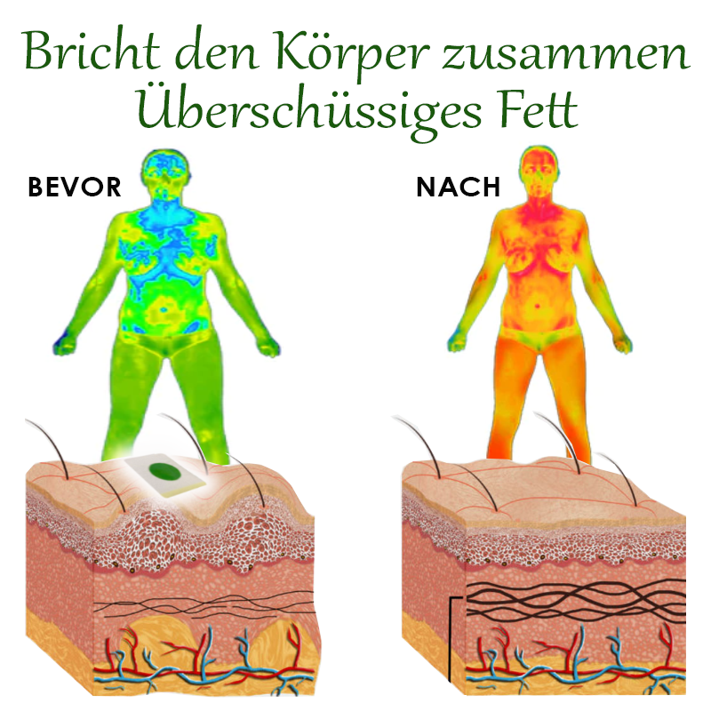 ATTDX Kräuter Abnehmen KörperEntgiftung Aufnäher