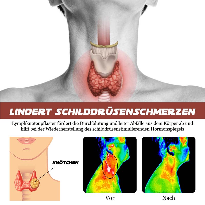 ATTDX Schilddrüse Lymphknoten Entwässerung Pflaster