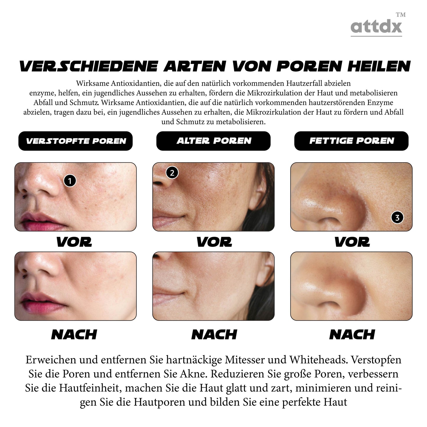 ATTDX Vulkanischer Schlamm Klarheit ÖlPurge Glühen Lehm Maske