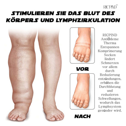 RICPIND AntiÖdeme ThermaEntspannen Komprimierung Socken