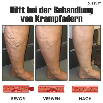 RICPIND AntiÖdeme ThermaEntspannen Komprimierung Socken