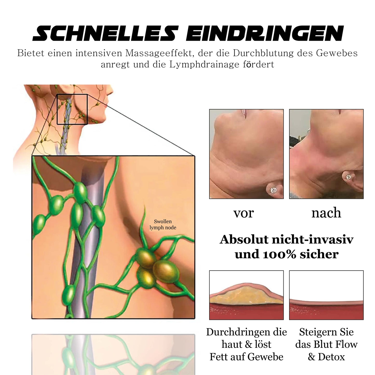 Ricpind EMS AnschwellenReduzieren EntgiftungTherapeutische Massagegerät