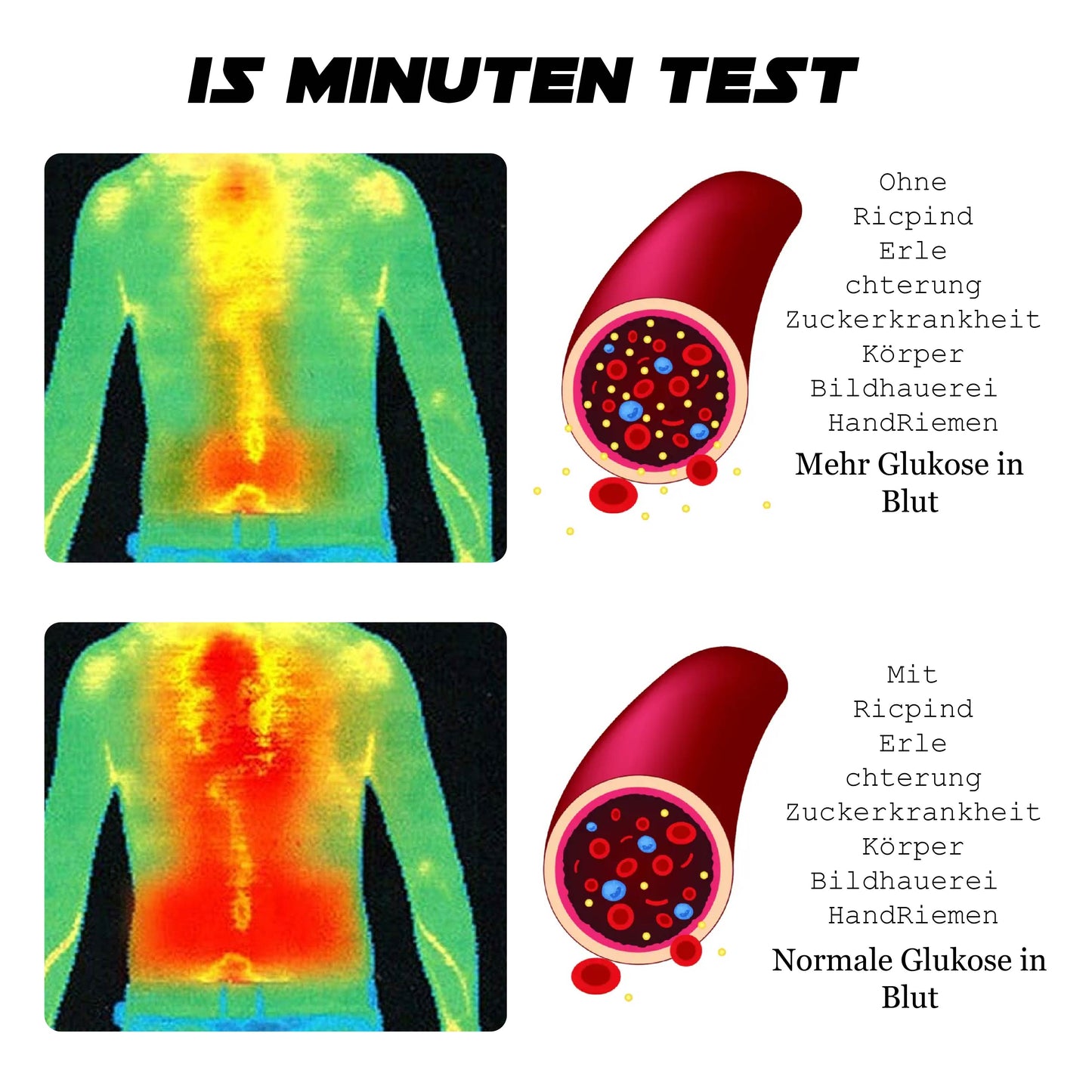 Ricpind ErleichterungZuckerkrankheit KörperBildhauerei HandRiemen