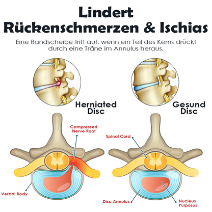 Ricpind SchmerzErleichterung IschiasTherapeutisch Kompression Gürtel