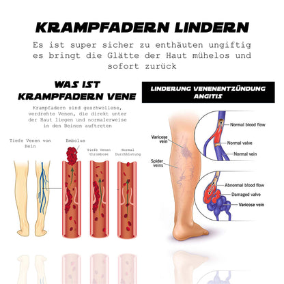 Ricpind TurmalinPro HeatingAcupressure Knieschutzhülse