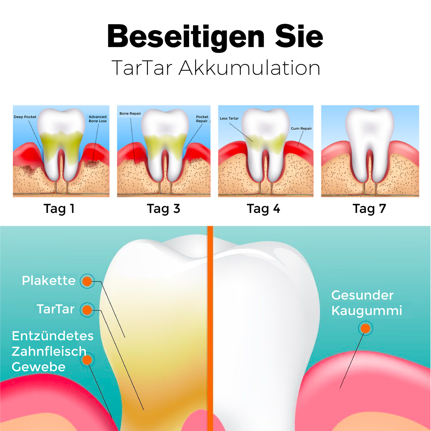 ATTDX ZähneReparieren Fleckenentferner Ampulle